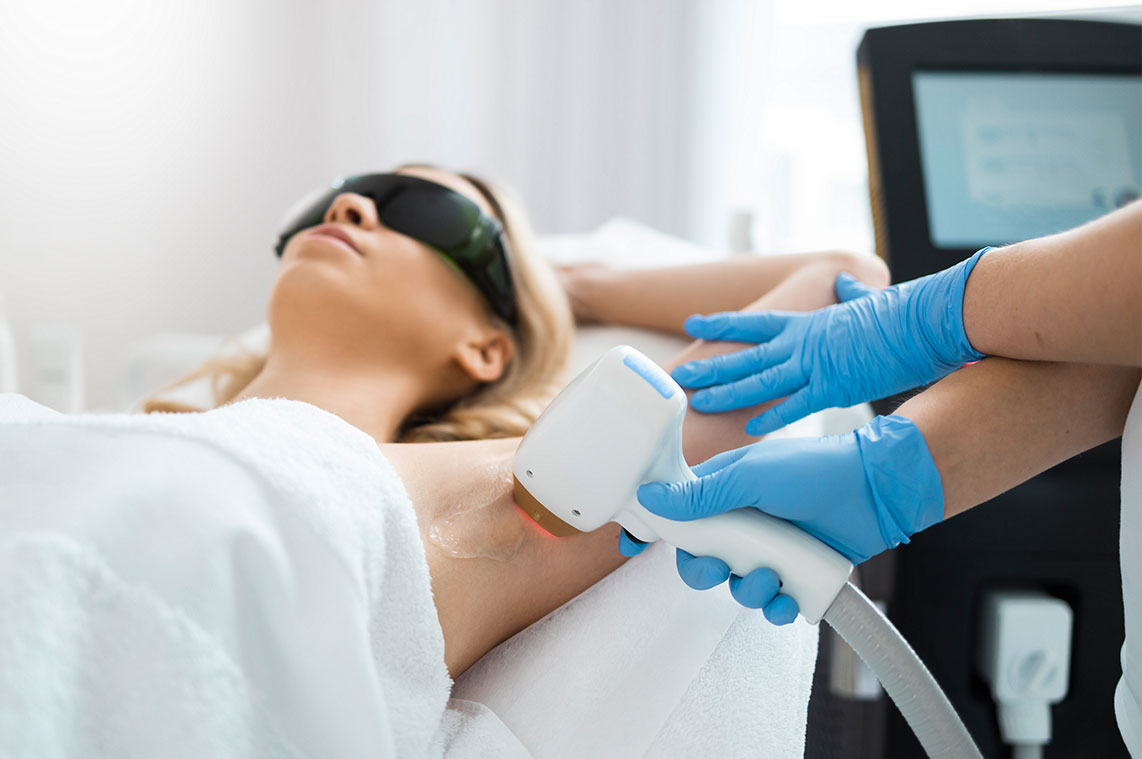 epilation laser