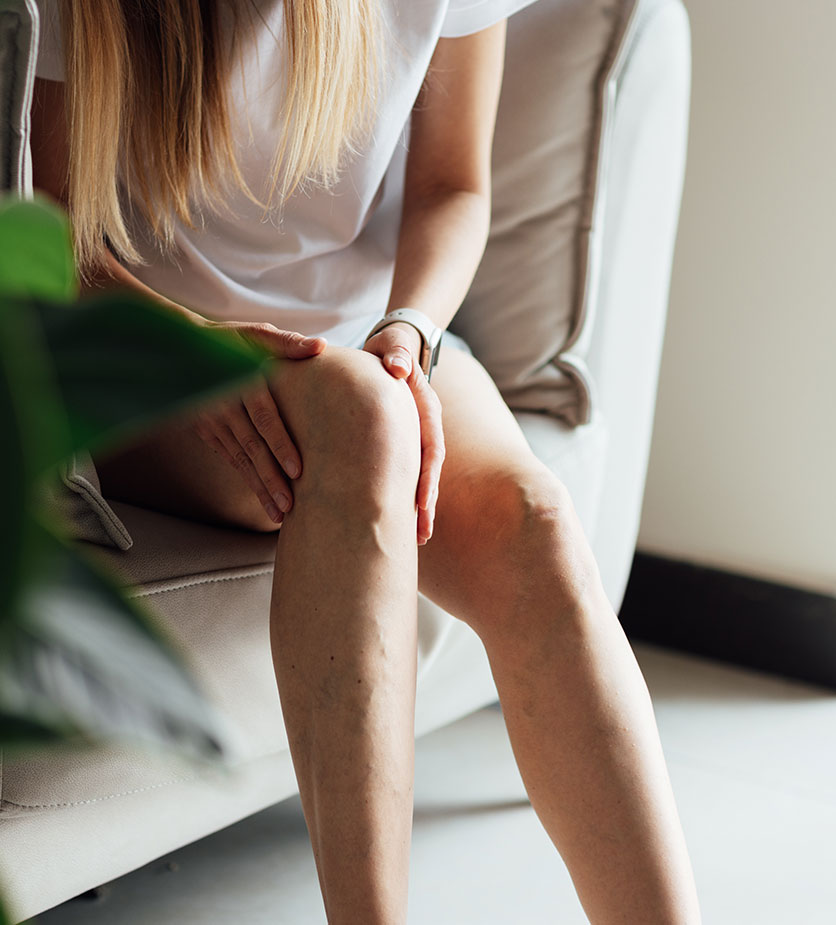 Varices : diagnostic et traitements